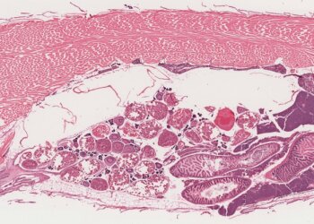 A importância do uso de biomarcadores histológicos em estudos de contaminação ambiental