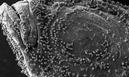 Amyloodinium ocellatum
